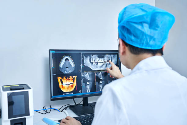 Best Emergency Treatment for Dental Infections or Abscesses in Lakeport, CA