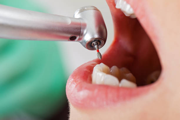 Best Cosmetic Emergency Dentistry in Lakeport, CA
